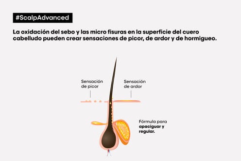 L'Oréal Professionnel - Serie Expert Scalp Advanced - Anti-Disconfort Champú - 300ml