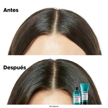 L'Oréal Professionnel - Serie Expert Scalp Advanced - Anti-Disconfort Champú - 300ml