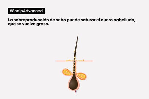 Champú Anti-Grasa Scalp Advanced - L' Oreal Professionnel