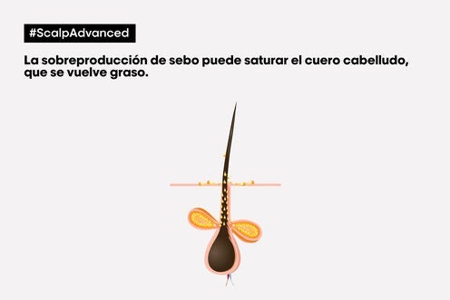 Champú Scalp Advanced Anti-Grasa - L' Oreal Professionnel