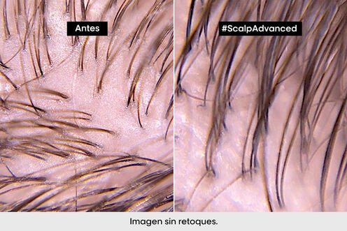 Champú Scalp Advanced Anti-Grasa - L' Oreal Professionnel