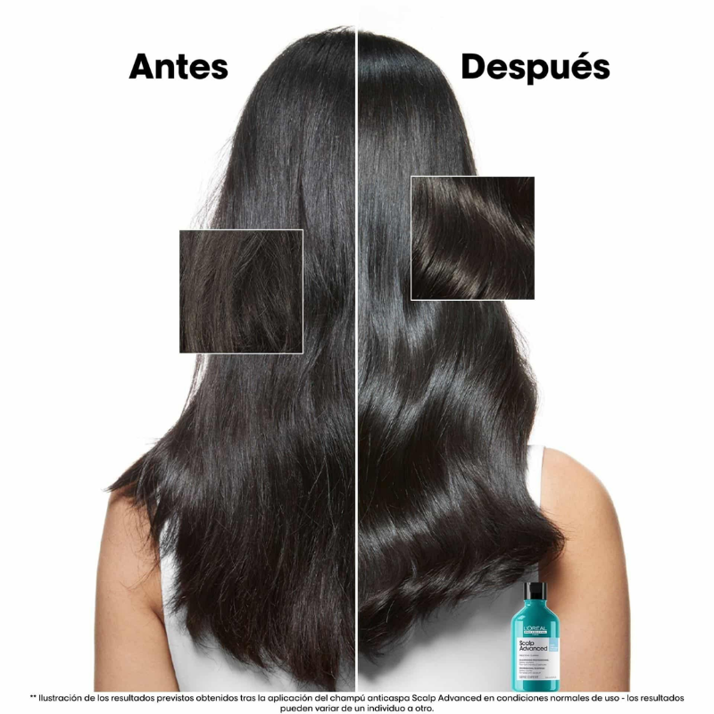 L’Oréal Professionnel - Refill Champú Scalp Advanced Anti Malestar - 500 ml