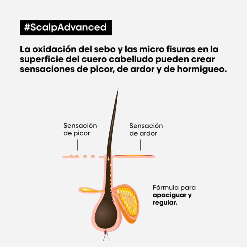 L’Oréal Professionnel - Acondicionador Anti Malestar 200 ml