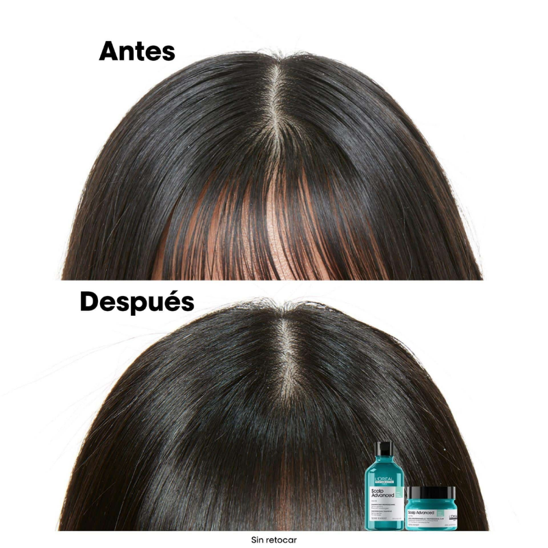 L’Oréal Professionnel - Champú Anti Grasa - 500 ml